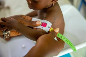 Child's arm being measured with a flexible tape measure marked in centimeters.